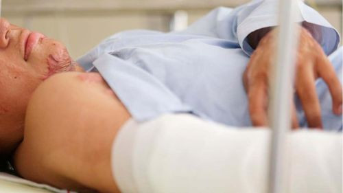 Adolescente prende fuego a su madre tras discusión porque no le compró comida