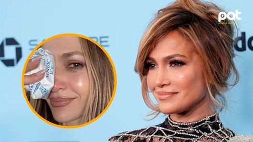 Jennifer Lopez sufre accidente durante sus ensayos, pero asegura estar recuperada