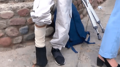 Niña de 10 años es arrollada y operada tras sufrir el robo de su celular en Cochabamba