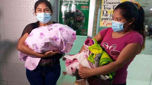 Dan de alta a la bebé que sufrió quemaduras de tercer grado