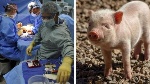 Riñón de cerdo funciona en un paciente por más de un mes en Estados Unidos