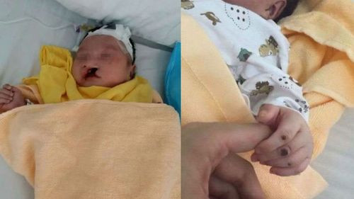 ¡Milagro en China! Bebé fue enterrado vivo y sobrevivió varios días bajo tierra