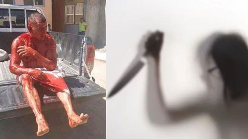 Honduras: mujer habría castrado a su esposo tras encontrarlo con otra mujer