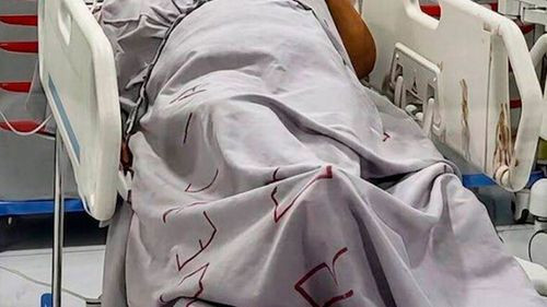 Conmoción en Pando: Madre apuñalada nueve veces por su hijo corrió por toda la casa para salvar su vida