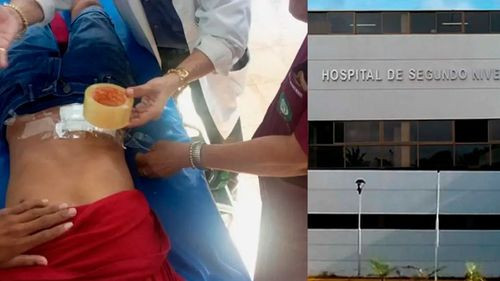 Denuncian uso de ‘yúrex’ en hospital de Riberalta; Alcaldía asegura dotación de insumos